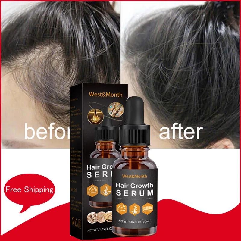 7 Days Fast Hair Growth Serum Thinning Treatment Bald Thicker Longer Stronger Prevent Hair Loss Repair Damaged Hair Care Product