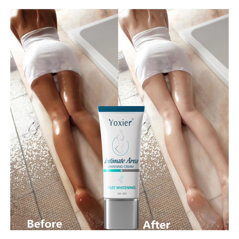 Отбеливающий крем для интимной области восстанавливающий эффект подмышки локтя