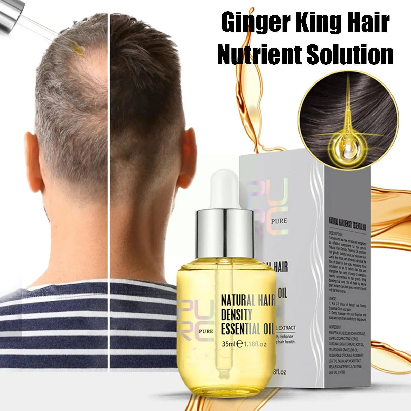 

1PCS 35ml Ginger Essence For Hair Growth Oil Men Women Thickening Grow Hair Treatment Products Dropshipping F4K3