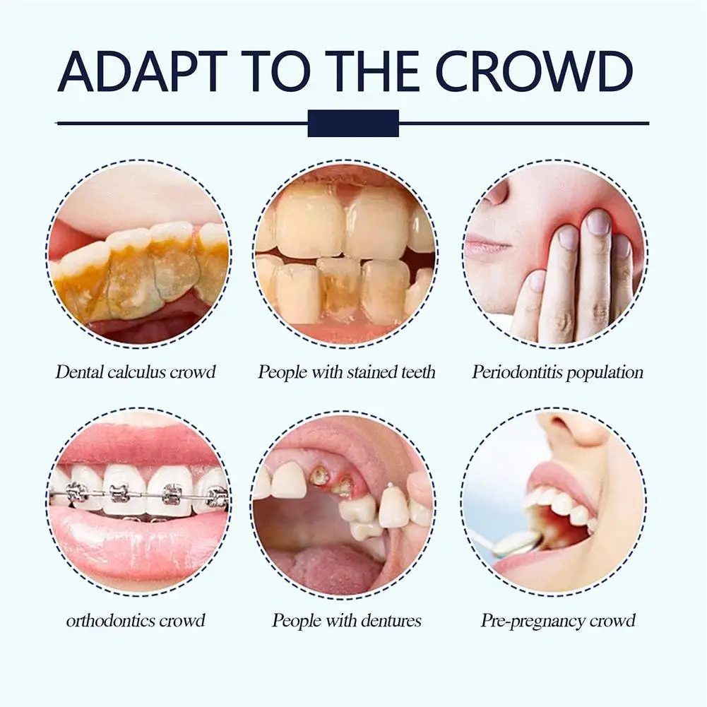 Рисунок 6 - Порошок для зубов Miyanxi