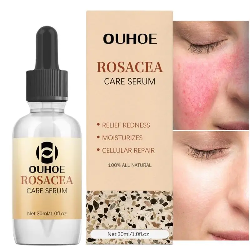 

Rosacea Skin Care Products Redness Serums Redness Reducing Treat Moisturizing Facial Serums To Repair Skin Barrier 1 Fl Oz