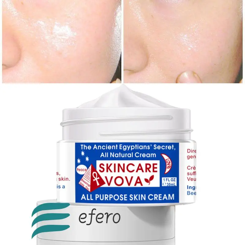 

Powerful Whitening Cream To Remove Freckles Dark Sunburn Spots Face Skin Care Moisturizing Creams Beauty Cosmetic Moisturizer