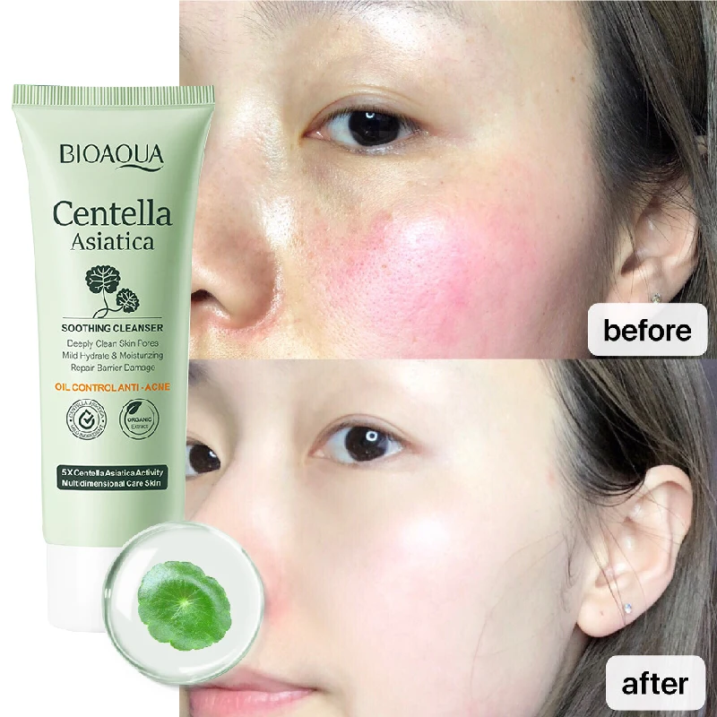 

Centella Asiatica Facial Cleanser Blackhead Removal Anti-acne Oil Control Face Cleansing Mild Soothing Non-Tightening Skin Care