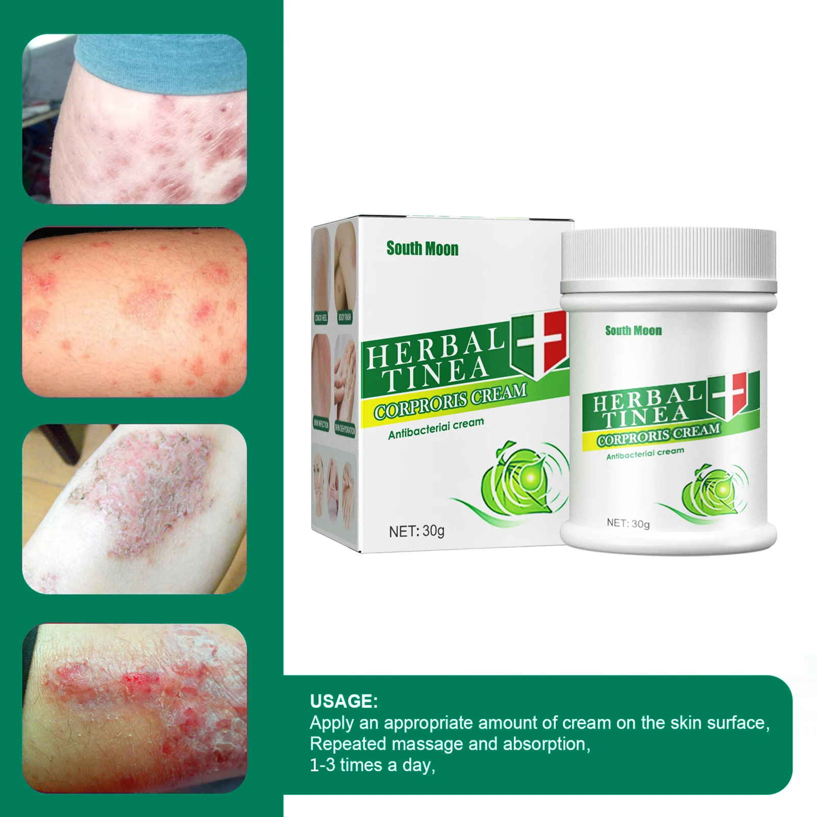 

Herbal Tinea Corporis Cream Herbal Formula Non-Irritating Antipruritic Ointment Antipruritic Ointment Ringworm For