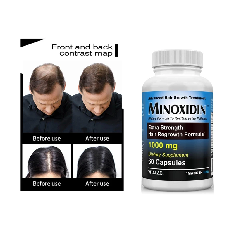 

Hair Growth Supplement 5,000 Mcg Capsules with Biotin - Hair Skin and Nails Vitamins - Hydrolyzed Collagen Biotin Pills