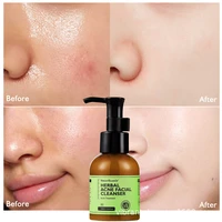 herbal acne facial cleanser 100ml gentle oil control deep cleaning soothing repair deeply cleans and moisturizes skin 1pcs