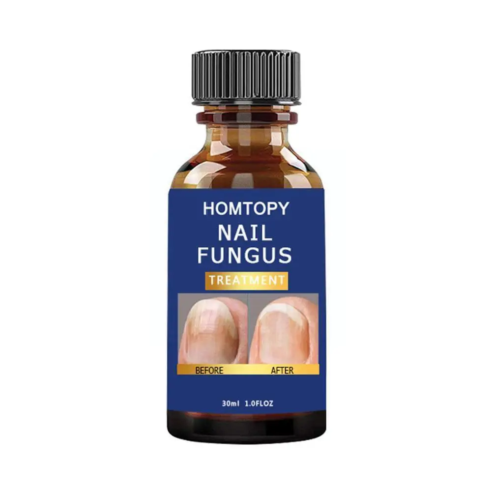 

30ml Nail Care Oil Nail Hardener Funguses Solution Extra Strength Nail Repair Liquid For Nails Nourishing Nail Care K8L7