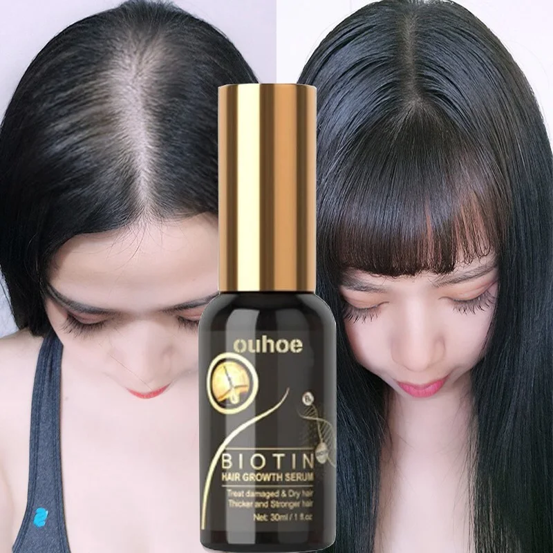 

Powerful Biotin Hair Growth Serum Liquid Hairs Thinning Treatment Products Thicken Anti-Hair Loss Scalp Care For Women Men 30ML