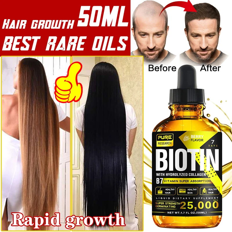 

Natural hair growth essential oil, rapid hair growth, scalp care, anti-hair loss, dry and frizzy, hair care for men and women.