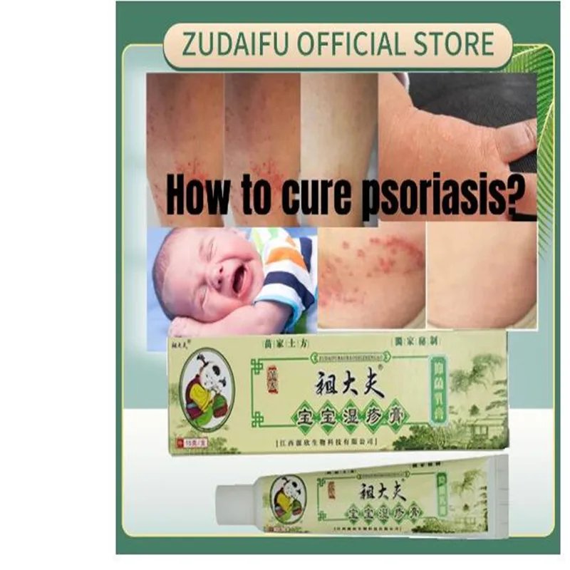 

5pcs/lot Zudaifu Skin Psoriasis Cream Dermatitis Eczematoid Eczema Ointment Treatment Psoriasis Cream Skin Care Cream For Baby
