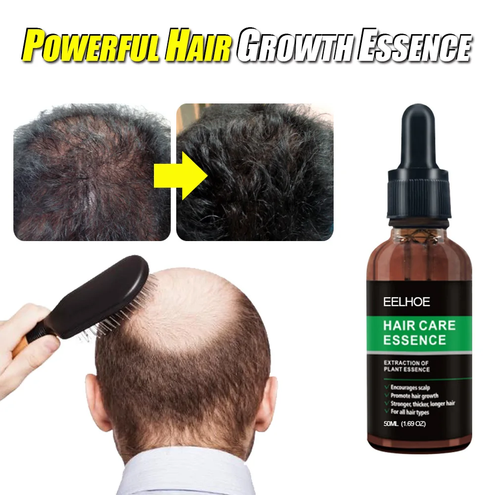 

30ml Hair Nourishing Nourishment Repair Lotion Care Head Hair Follicle Care Scalp Care Lotion