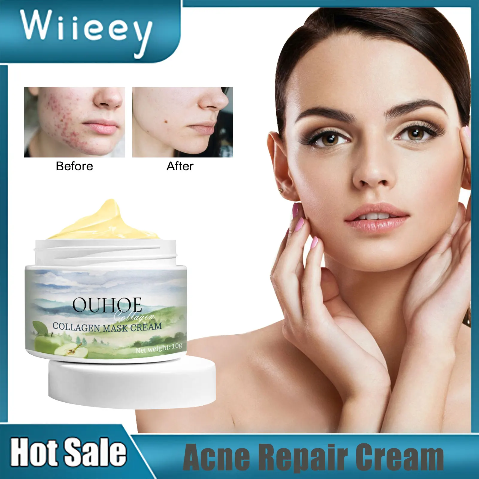 

Acne Marks Removing Cream Effective Fade Pimple Scars Moisturizing Oil Control Pores Shrinking Whitening Pimple Treatment Cream