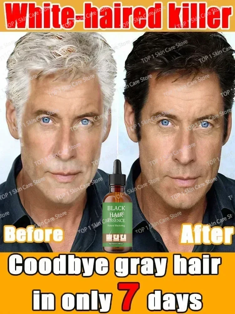 Натуральная Сыворотка против седых волос-восстанавливает белые и затемняющие