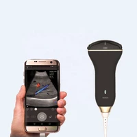 healson c30c convex cheapest usb smartphone portable ultrasound machine