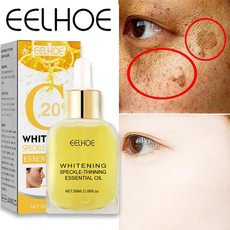 

Vitamin C Freckle Whitening Face Serum Removal Dark Spots Melasma Brighten Lighten Melanin Improve Dull Beauty Health Skin Care