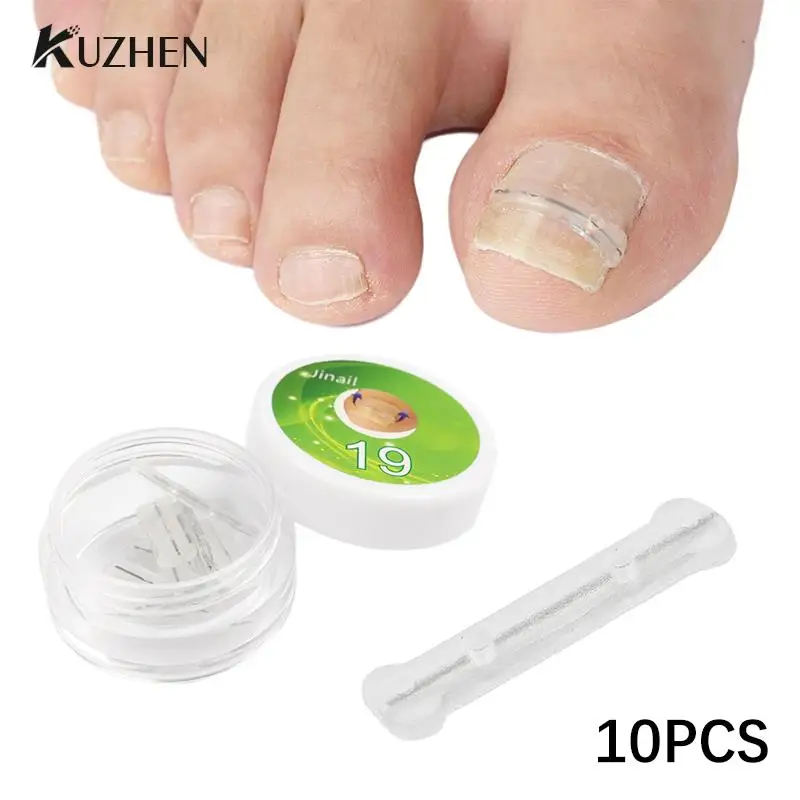 

10pc/box Ingrown Toenail Correction Tool Ingrown Toe Nail Treatment Elastic Patch Sticker Straightening Clip Brace Pedicure Tool