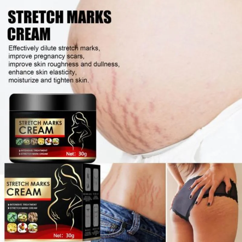 

Functional Healthy Lighten Scars Improve Moisture Mommy Care Belly Maternity Marks Gel for Abdomen Ointment