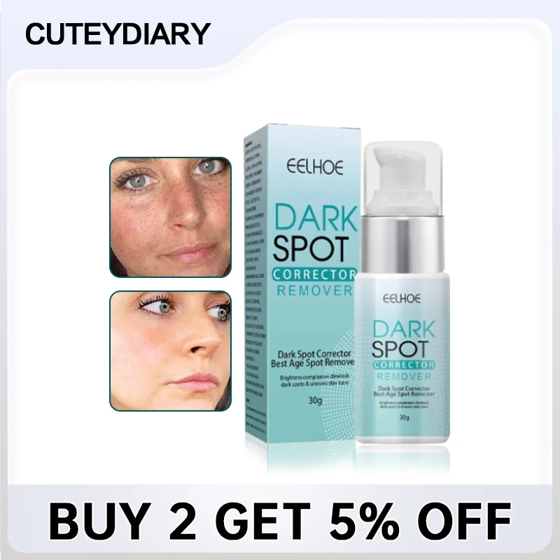 

Nicotinamide Whitening Freckle Cream Dark Spot Remover Skin Care Products Moisturizing Brighten Pigment Correction Face Beauty