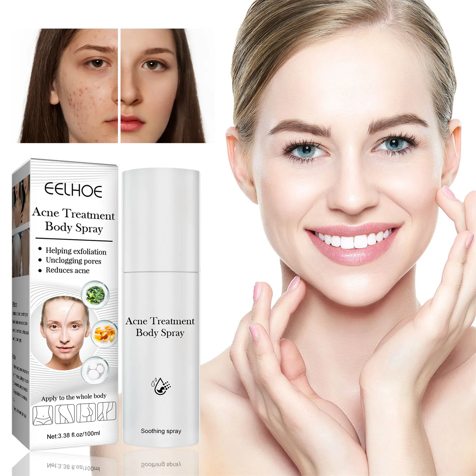 

Отбеливающий крем-спрей для коррекции темных точек, ингибиция веснушек, увлажняющее средство для лечения пигмента, уход за кожей меланина