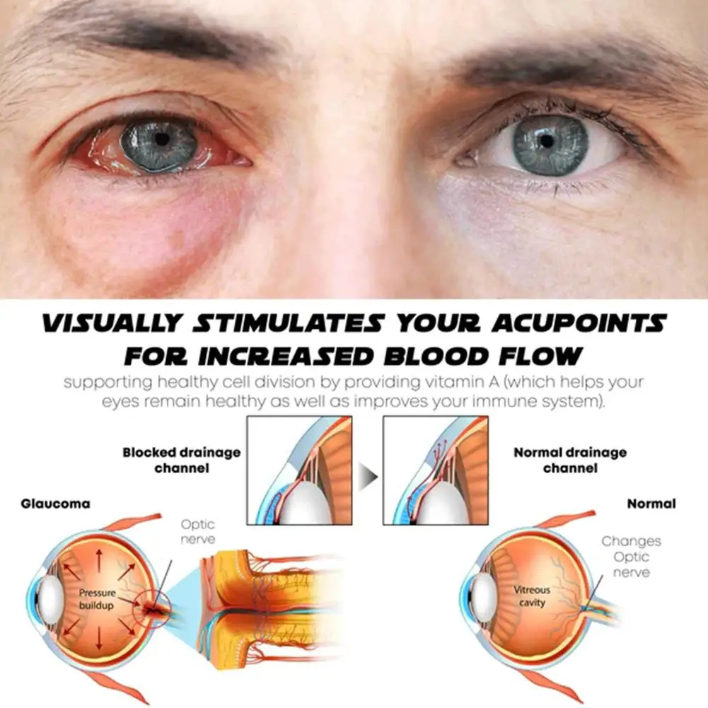 

Eye Wash Artifact Atomized Face Eyewash Cleansing Steamer Antibacterial Symptom Dry Anti-inflammatory Eye Fatigue Relief Wa W8V8