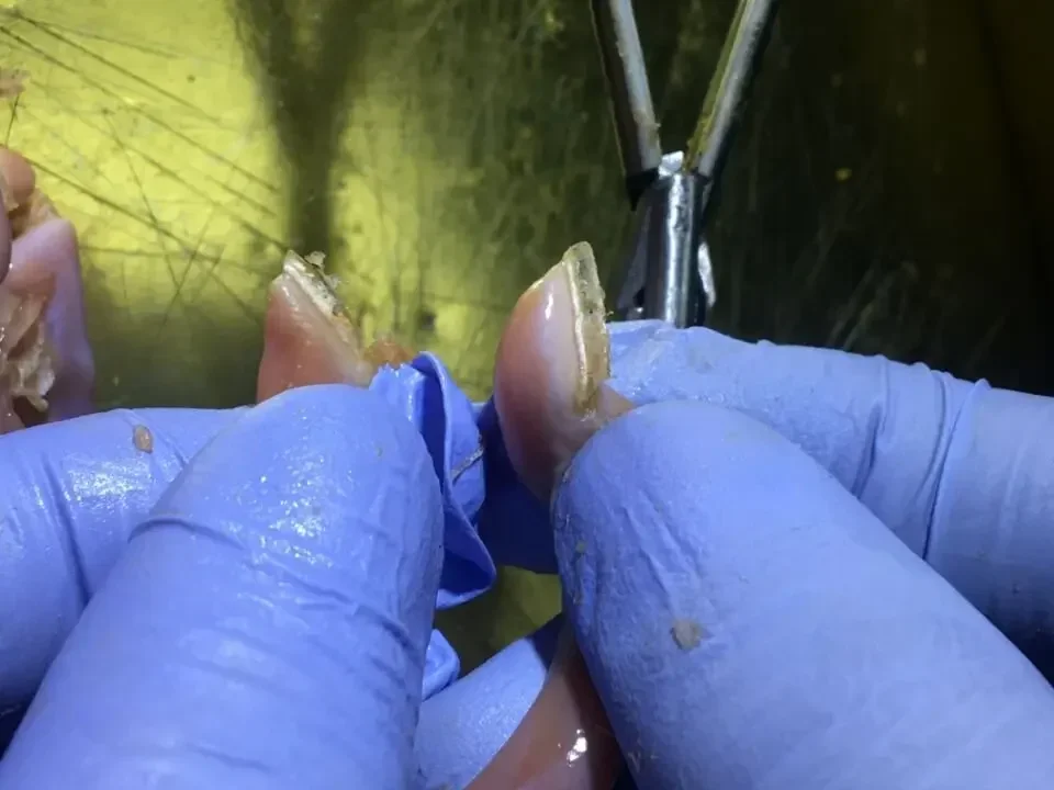 Герметик для сосудов ligasure Maryland герметик/Разделитель с нанопокрытием и