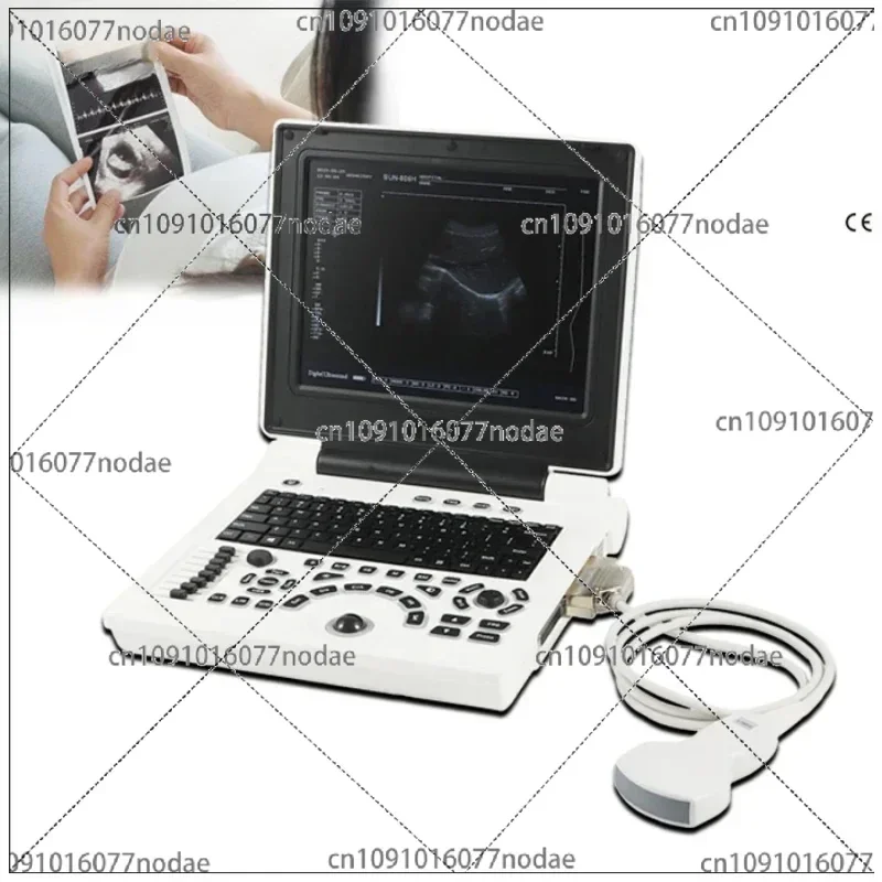 Дешевый ноутбук Ecograph черно-белый ультразвуковой апарат дешевый чем 2D-аппарат Logiq