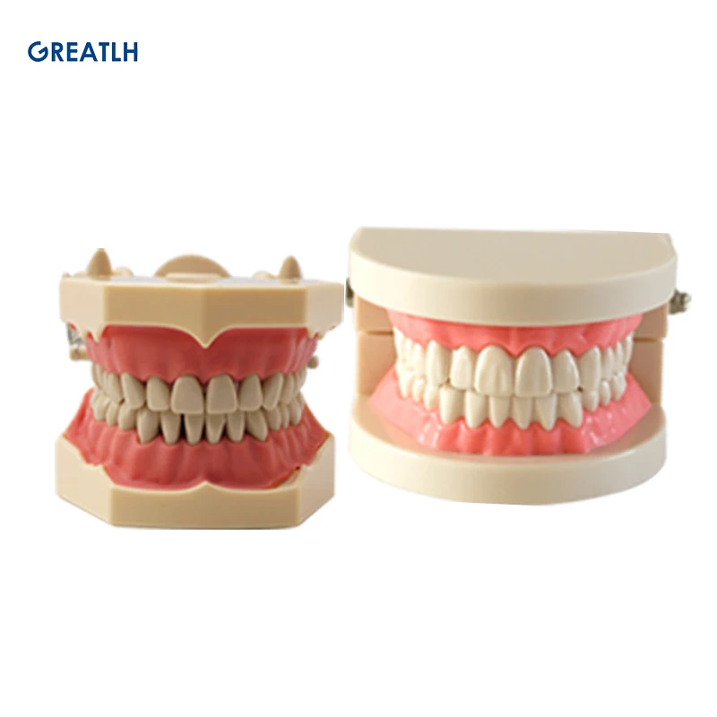 

Dental Implant Disease Teeth Model with Restoration Bridge Tooth Dentist for Medical Science Dental Disease Teaching Study
