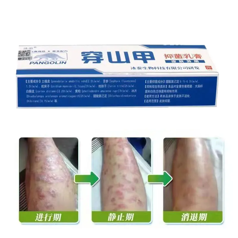 

Skin Care Products Effective Anti-Itch Skin Repair Cream Dermatitis Eczematoid Ointment Psoriasis Antibacterial Cream