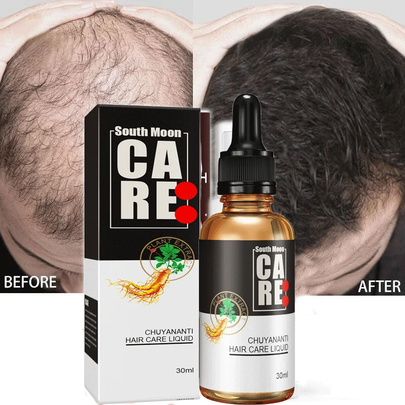 

Dense Hair Growth Essence Oil Natural Anti Hair Loss Prevent Baldness Treatment Fast Growing Nourish Dry Damaged Hair Care 30ml