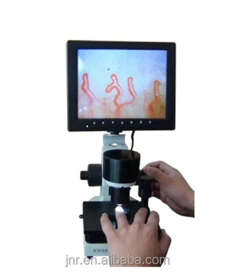 

Health checking microcirculation machine