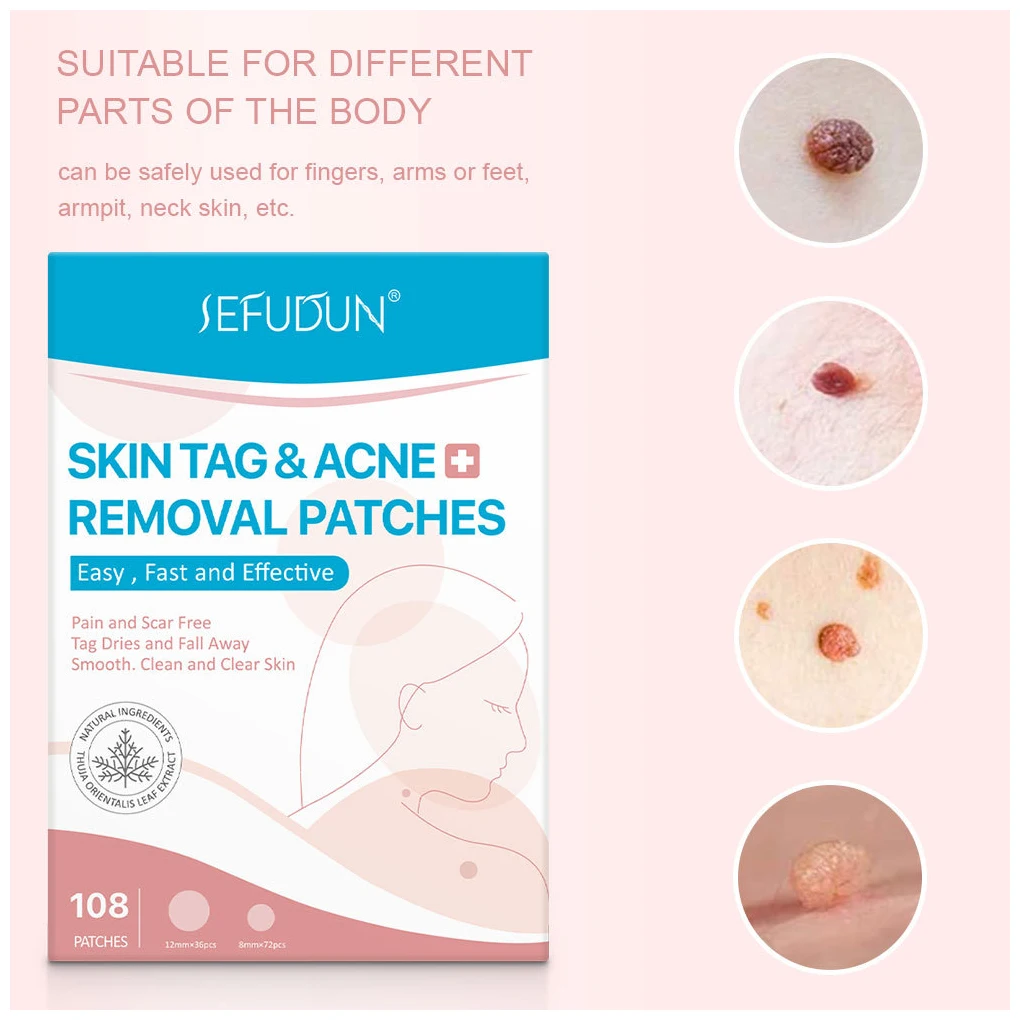 

108pcs Skin Tag Remover Warts Remover Patch Wart Treatment Cream Herbal Extract Foot Corn Plaster Acne Warts Ointment