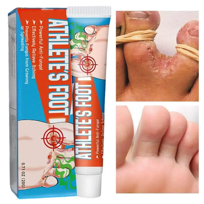 

20g New Anti Athlete's Foot Cream Onychomycosis Paronychia Toe Nail Cream Repair Feet Care