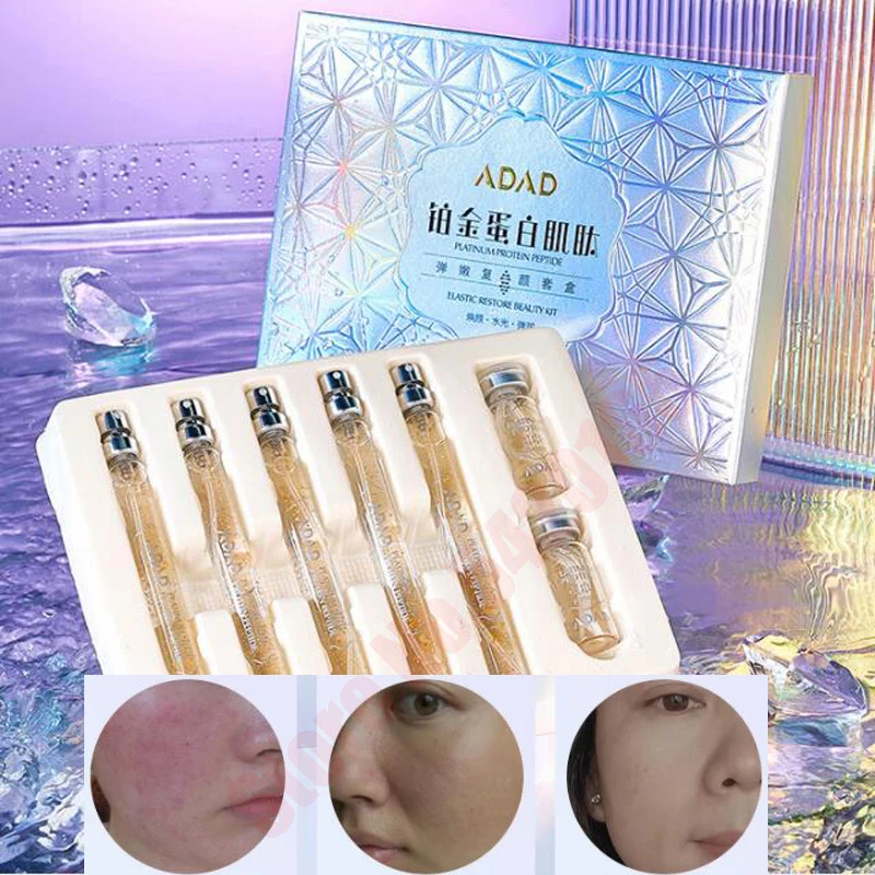 

Face Lift Plump Protein Thread Line No Needle 24K Gold Protein Line Absorbable Anti-wrinkle Face Filler Collagen