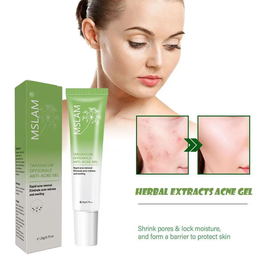 Эффективный крем для удаления прыщей травяное масло от увлажняющий отбеливающий
