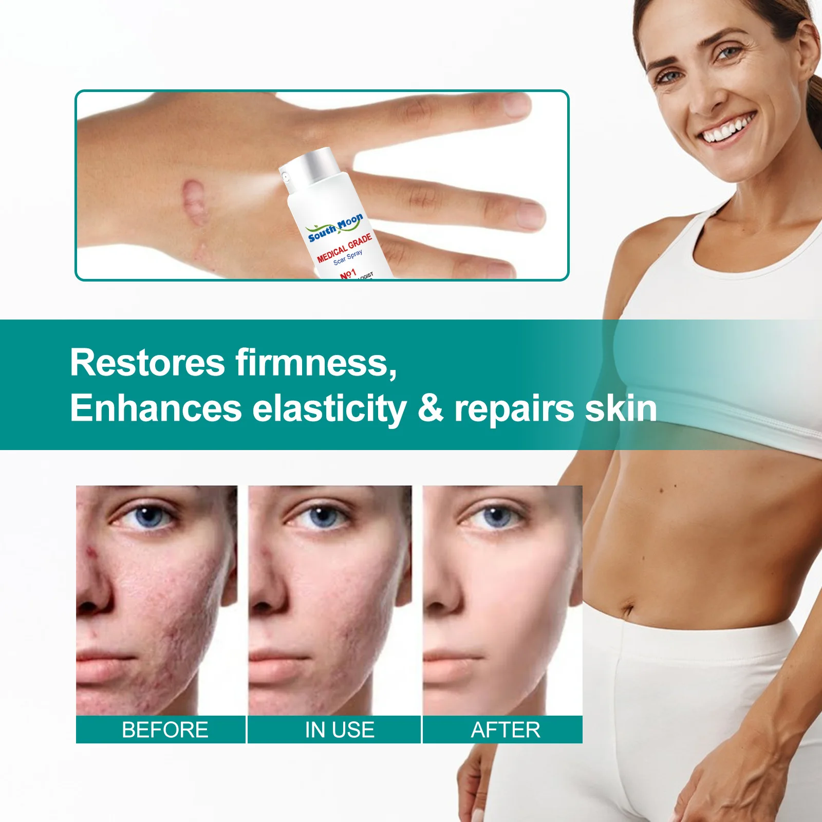 To Fade Scar Pregnancy Scar Smoothing Skin Care Spray Improve Skin Smoothness And Promote Collagen Activation