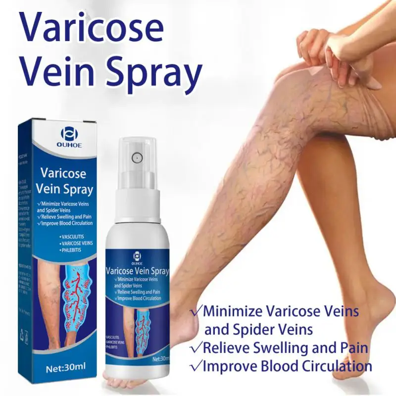 

30ml Varicose Veins Spray Varicosity Repair Cream Blood Vessels Bulge Swelling Varicocele Remove Relief Pain Legs Phlebitis Legs