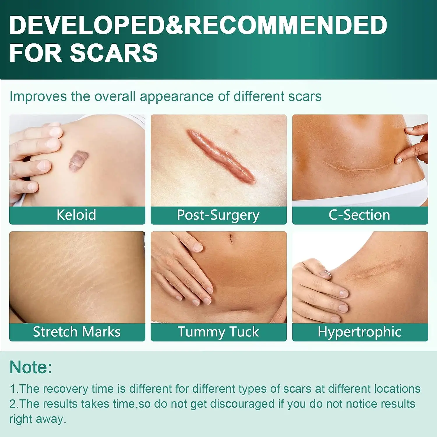 Пластырь силиконовый для удаления рубцов 150/450 см