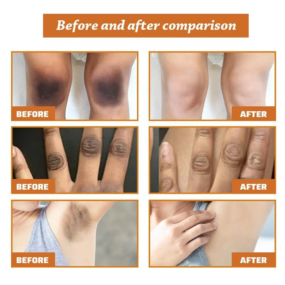 Рисунок 5 - Увлажняющая отбеливающая Сыворотка для тела