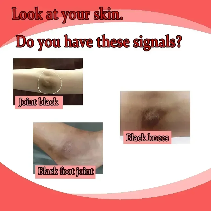 Осветляющий крем для лица тела бедра подмышек внутреннего меланина легкий