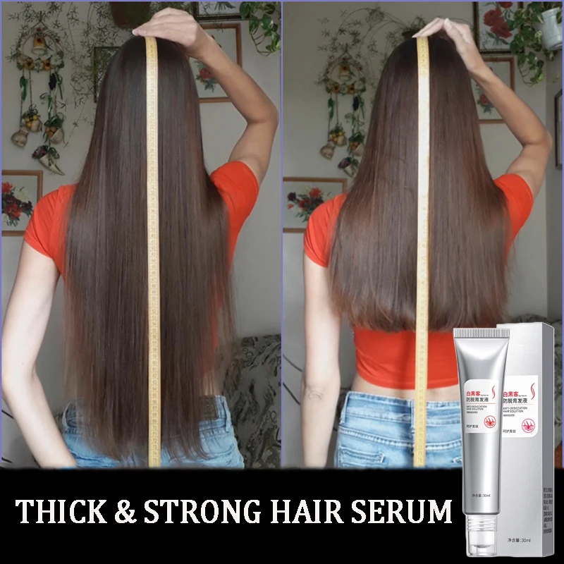 

Fast Growing Hair Essential Oil With Rolling Ball Hair Follicle Repair Growth Beauty Care Prevent Hair Loss Oil Scalp Treatment