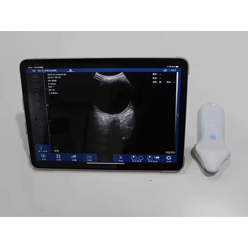 Фото SY-AM01 Беспроводной зонд Офтальмологический сканер Микровыпуклая карман для ладони №3