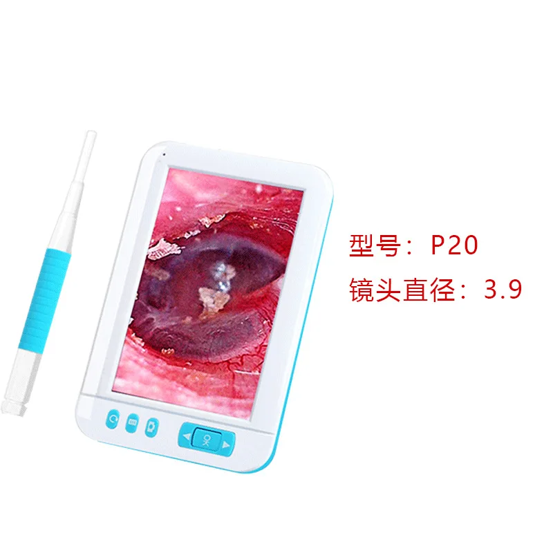 【200Ten Thousand】Экран высокой четкости визуальный ушной выбор коммерческое