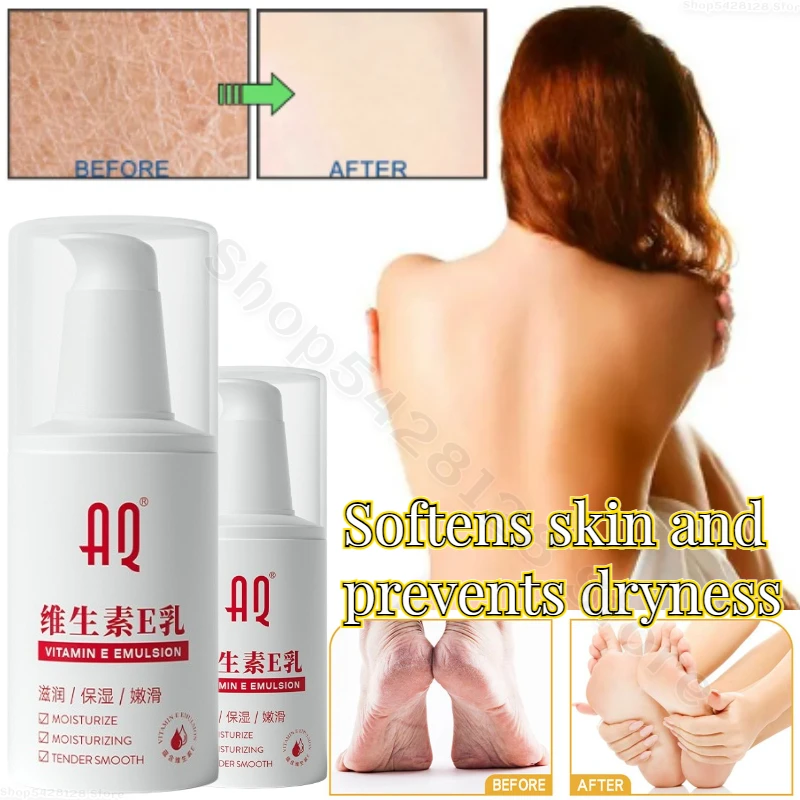 

Vitamin E Face Cream Body Lotion Hand Cream Moisturizing Relief Chapped Peeling Skin Exfoliation Hand Care Whitening Cream 100ml