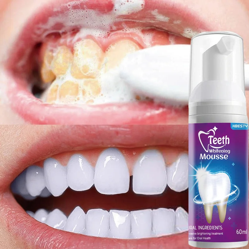

60g Teeth Whitening Toothpaste Mousse Deep Cleaning Cigarette Stains Yellow Teeth Plaque Remove Breath Fresh Whiten Tooth Care