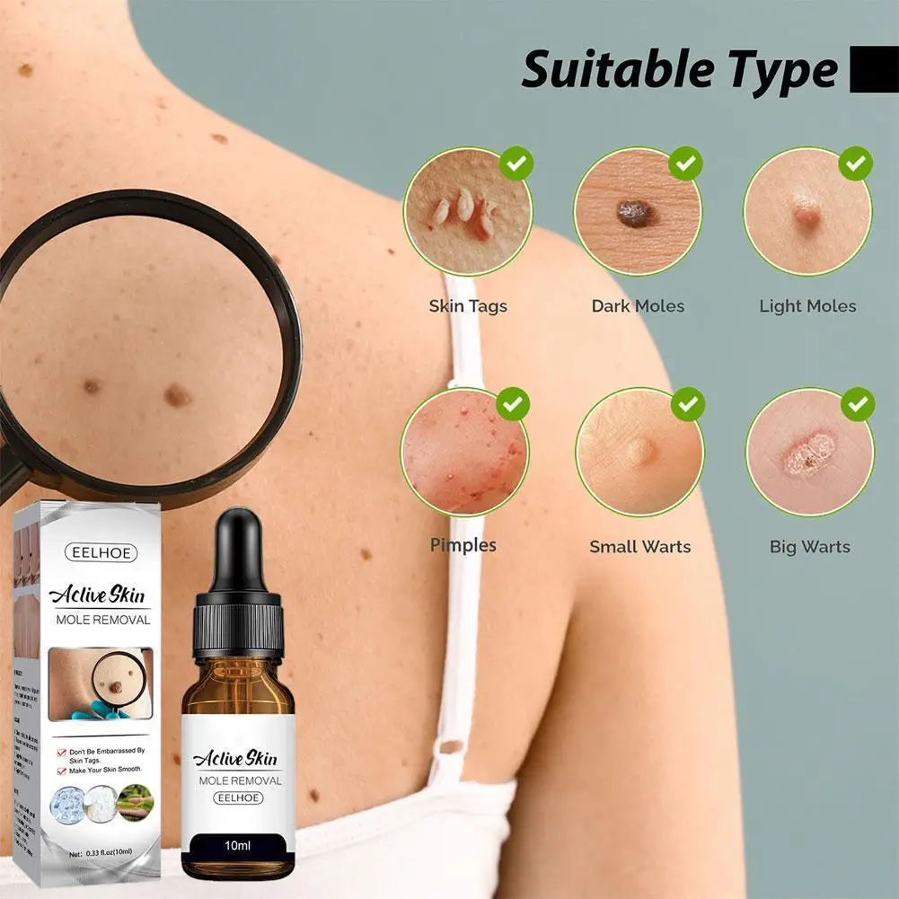 

Skin Warts Tags Moles Remover Anti Verruca Remedy Warts Of Skin From Papillomas Liquid Treatment Tags Essence Removal