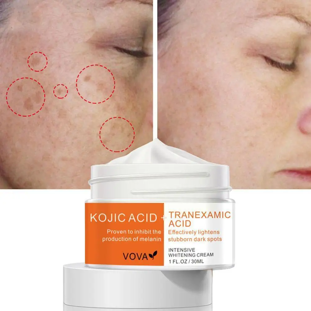 

30g New Whitening Cream Remove Dark Spots Pigment Fade Removal Acne Skin Whiten Melanin Cream Melasma Spot Care Freckle W2g4