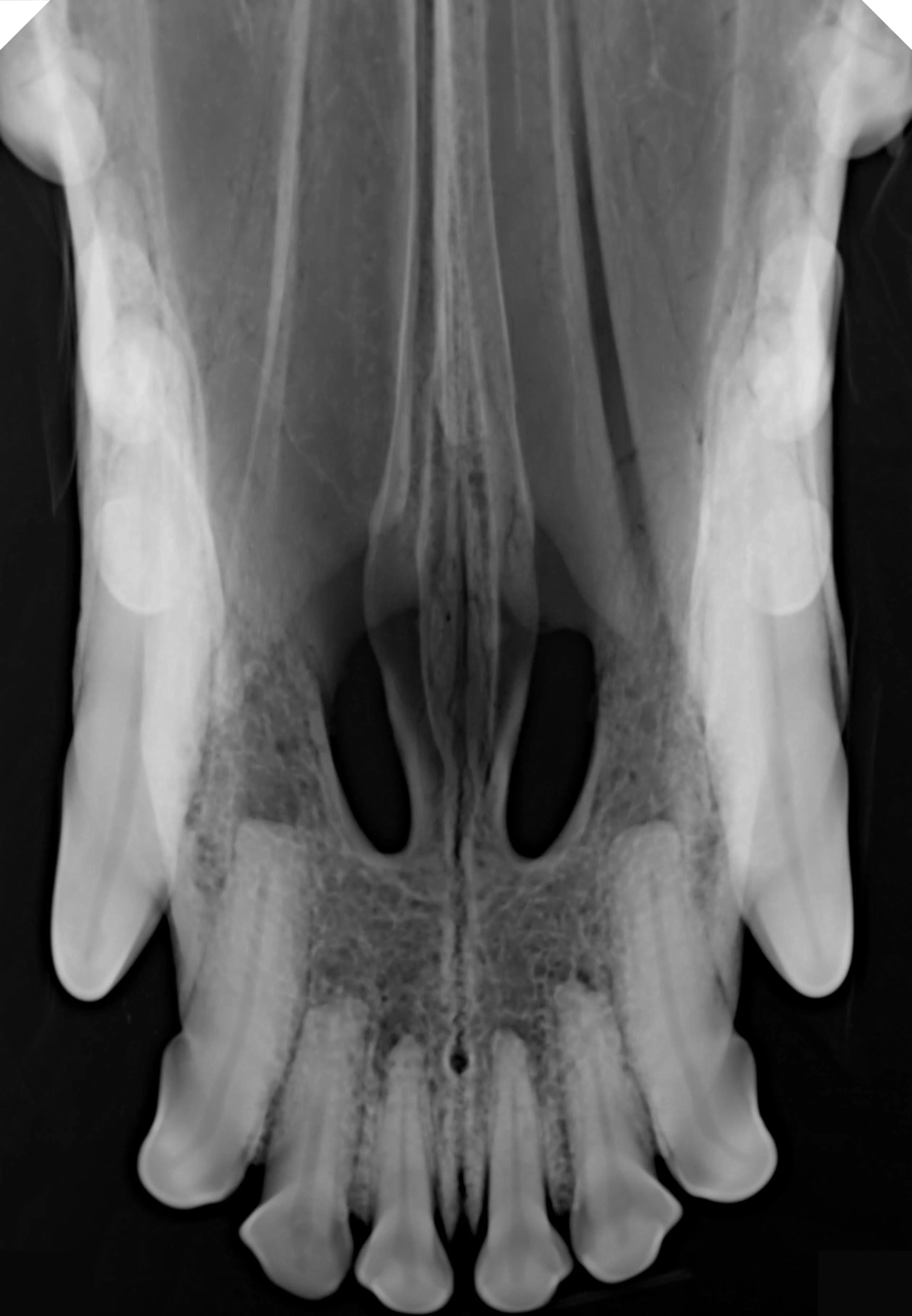 Оригинальный датчик изображения РУЧНОГО размера 4 рентгеновская панель для