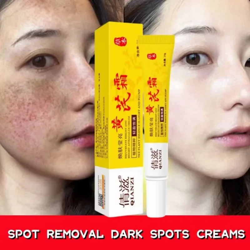 Осветляющий крем для лица Ниацинамид уменьшает концентрацию хлоазмы мелазмы