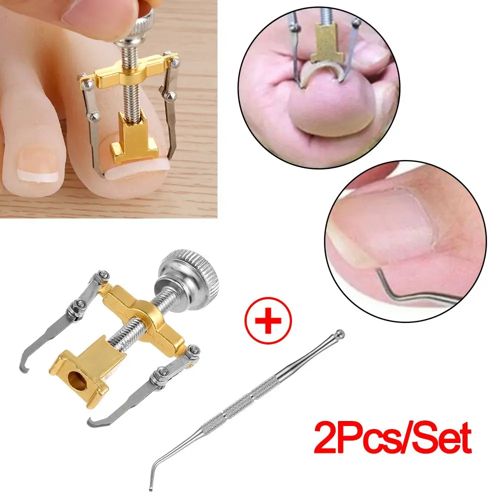 

Эффективный Толкатель для кутикулы для взрослых, средство для восстановления ногтей, паринихия, вросший ноготь, коррекция ногтей, набор инс...