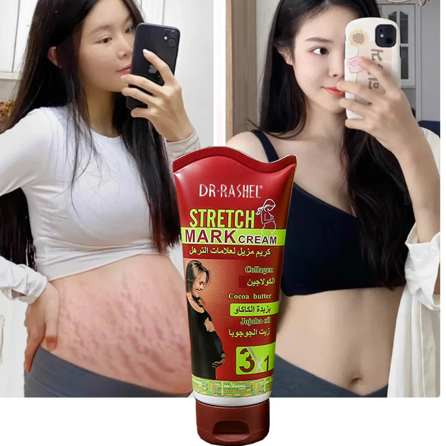 

Cocoa Butter Formula Remove Pregnancy Scars Stretch Marks Treatment Maternity Repair Anti-Winkles Firming Body Creams Skin Care